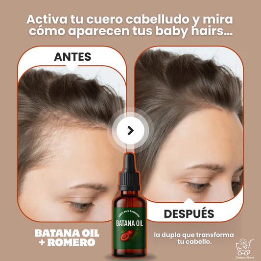 Aceite de Batana Natural Recupera Tu Cabello